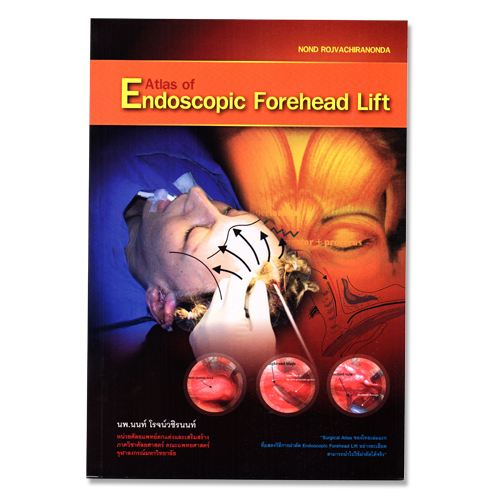 หนังสือ Endoscopic Forehead Lift